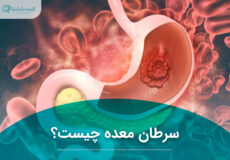 سرطان معده چیست؟