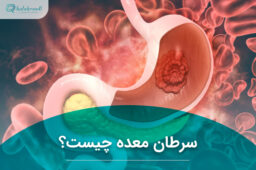 سرطان معده چیست؟
