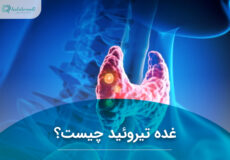 غده تیروئید چیست؟